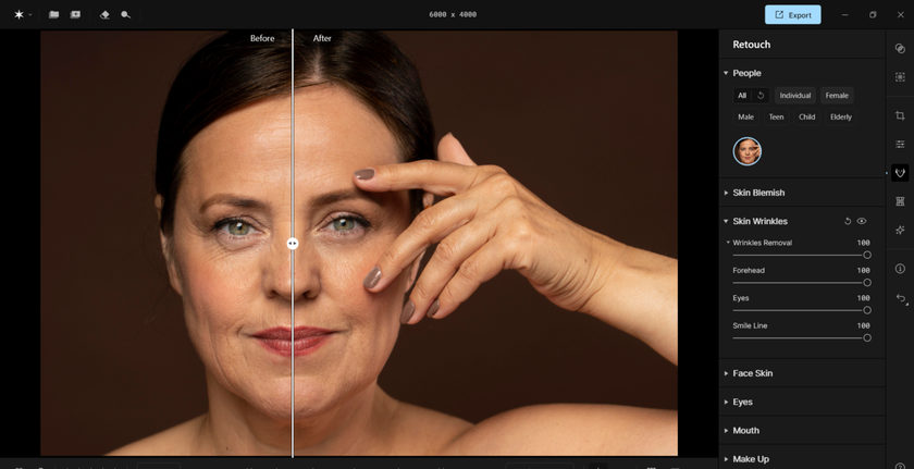 Skin Wrinkles in Aperty | Aperty Blog
