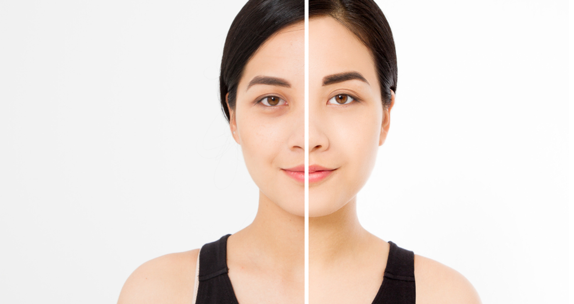 How To Remove Dark Circle Under Eyes From Portrait Shots