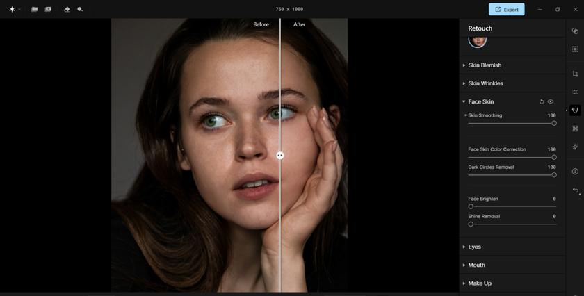 Dark Circles Remover in Aperty | Aperty Blog