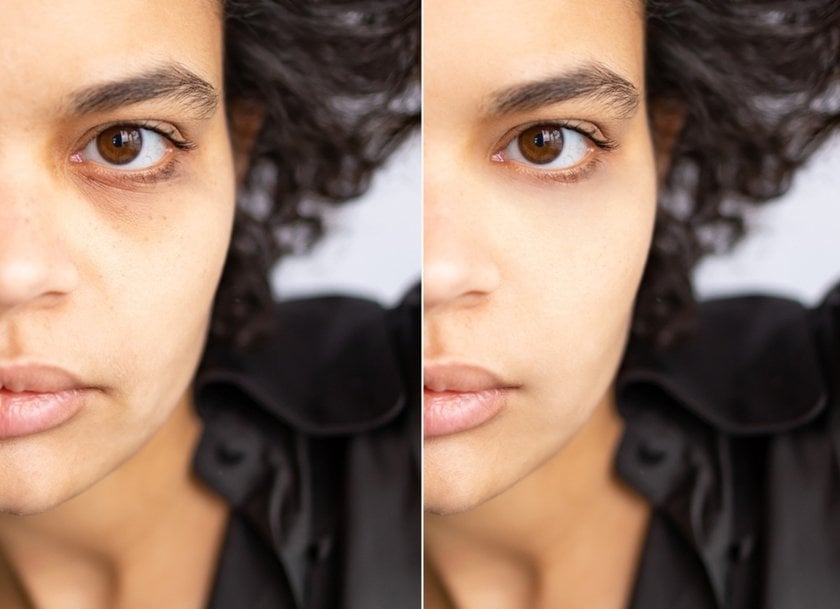 Girl with dark circles under her eyes | Aperty How To
