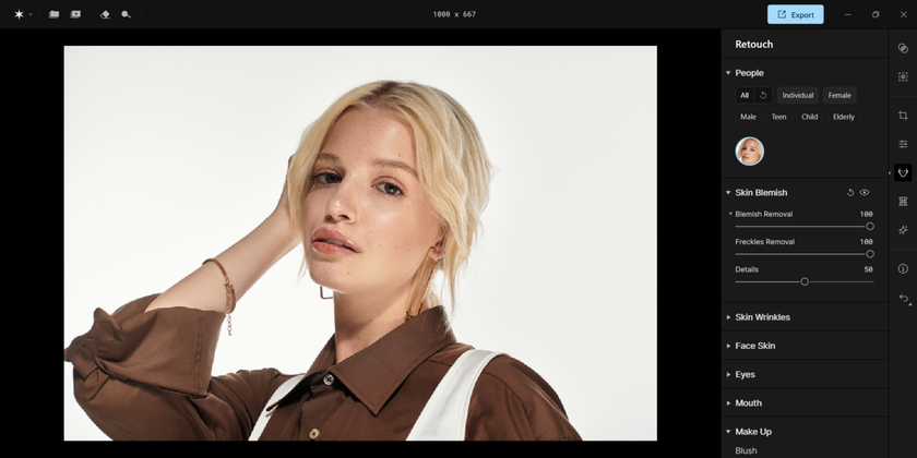 Skin Blemish in Aperty | Aperty How To