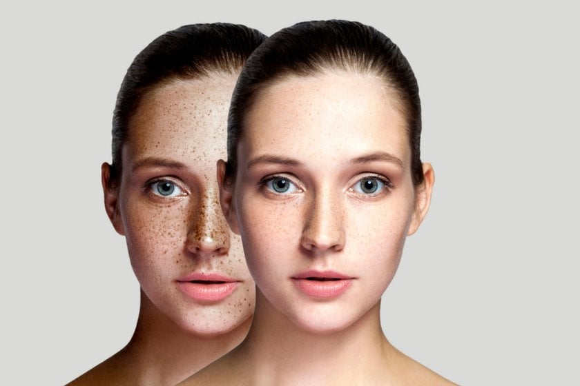 Photo of edited facial skin| Skylum Blog