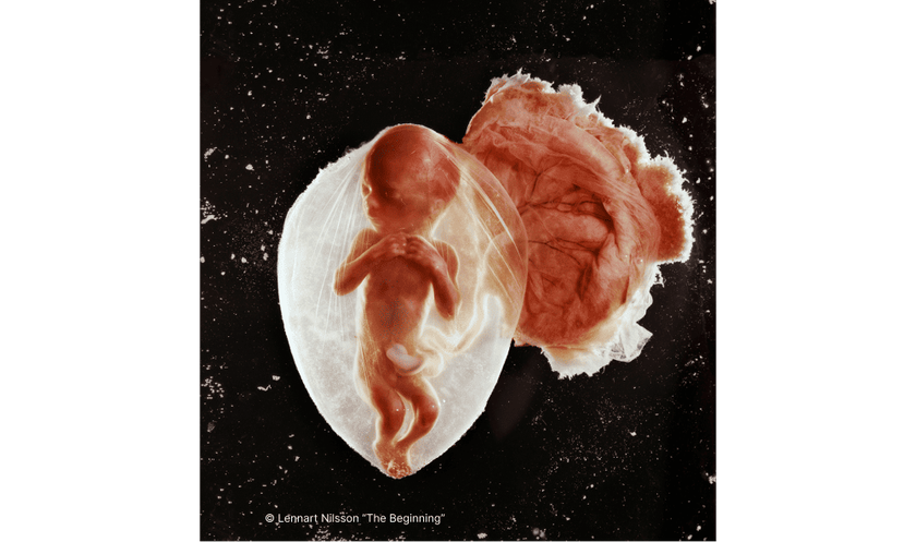 Fetal Photograph by Lennart Nilsson | Skylum Blog