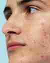 Skin AI before