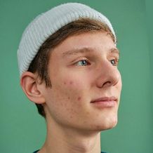 A portrait before skin retouch